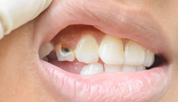 Peptides in dentistry